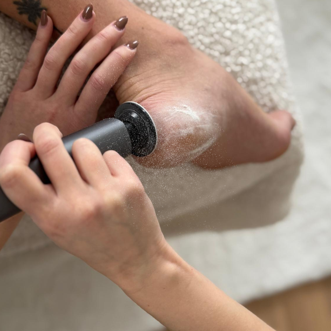 Olysara™ Ultra-Smooth Portable Callus Remover With CrystalGlide Technology™